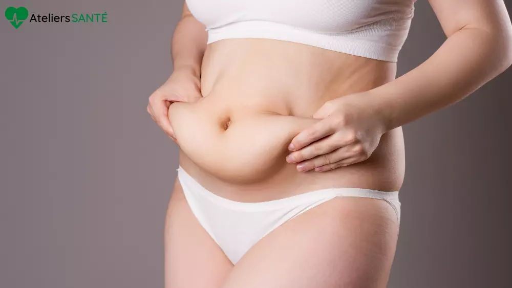 abdominoplastie